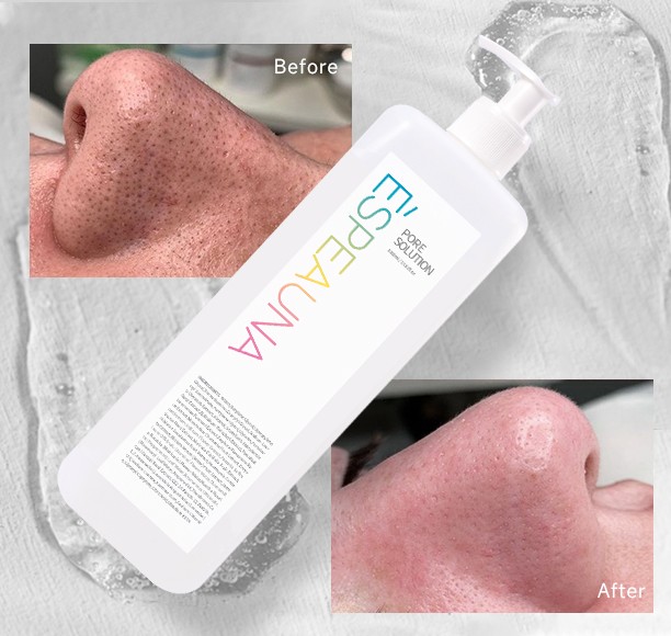 诗薄娜毛孔清洁液 1000ml -4.jpg